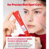 COSRX Azelaic Acid 20 B5 Redness Soothing Cream
