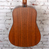 Martin - 2026 D-X2E Molly Tuttle - Acoustic-Electric Guitar - Vintage Sunburst - with  Softshell Case (11DX2EMOLLYTUTTLE)