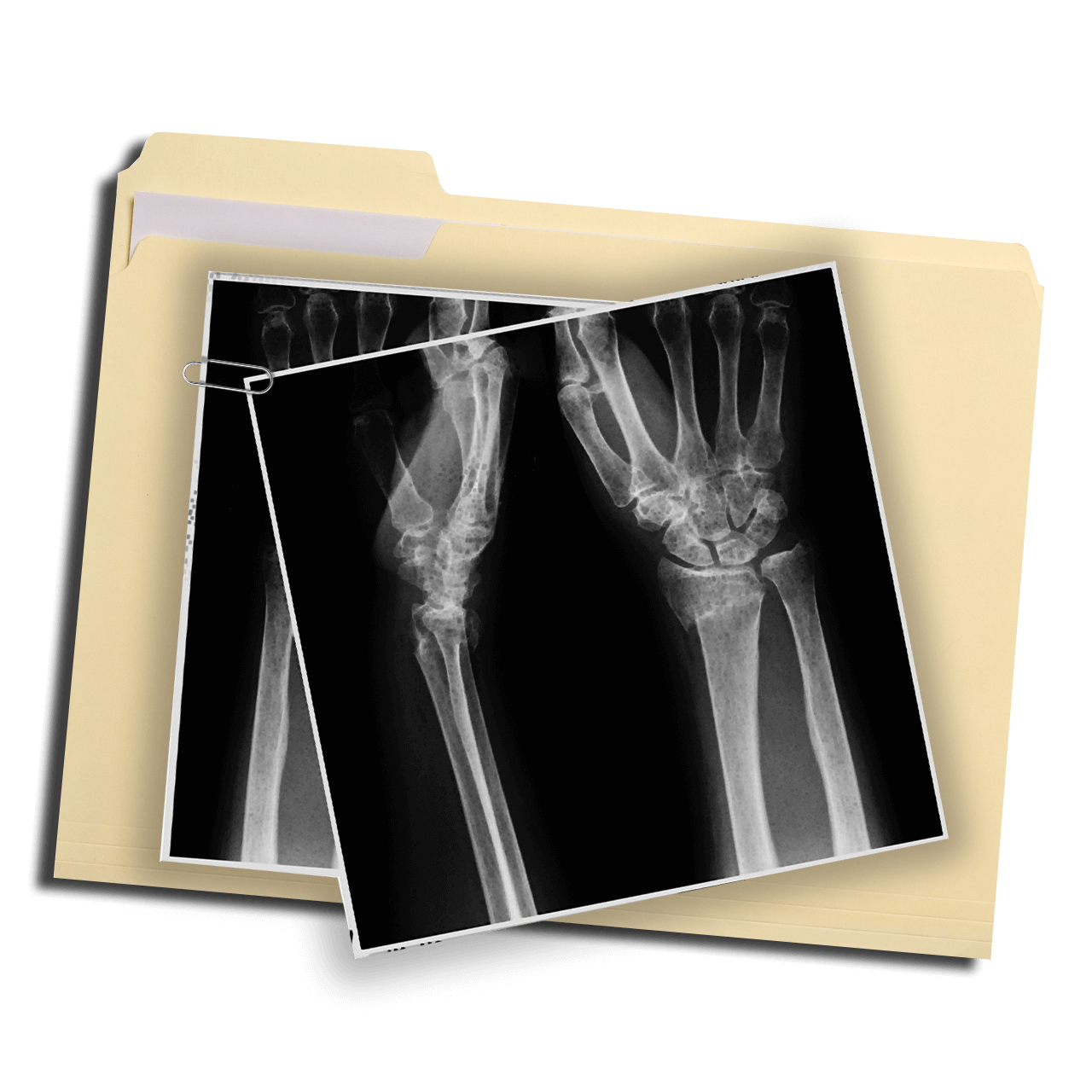 Wrist X-Ray