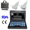 10.1 Fda Ce Human Laptop Ultrasound Scanner B-ultrasound Convex+linear,us Fedex