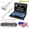 Portable Laptop Ultrasound Scanner Diagnostic System Convex Transvaginal 2 Probe