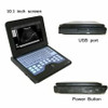 Laptop Machine Digital Ultrasound Scanner Portable Convex+transvaginal 2 Probes