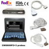 Portable Ultrasound Scanner Laptop Machine 3 Probes,convex Linear Cardiac