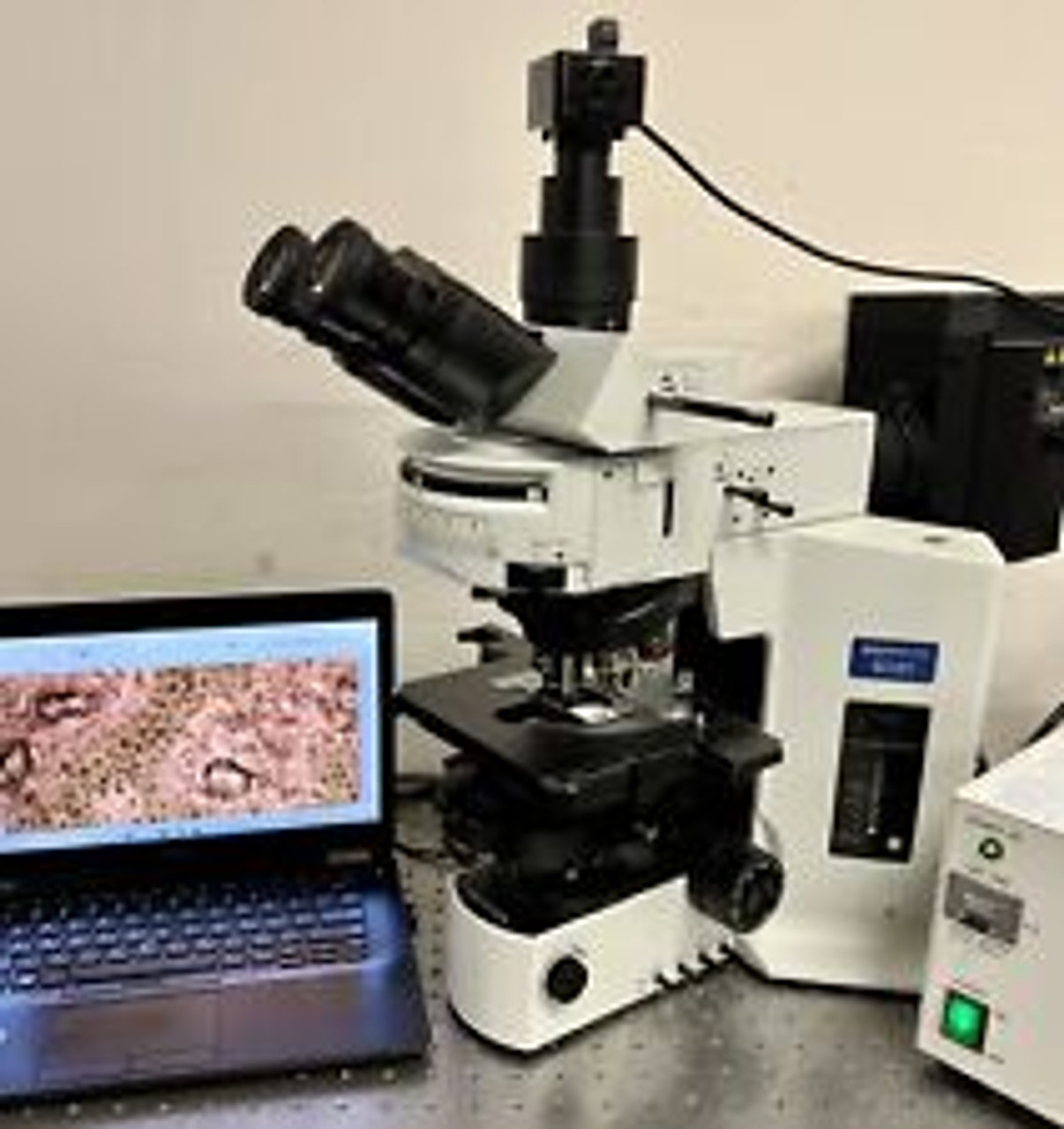 Olympus BX51 Fluorescence Phase Contrast Microscope 5MP Cam Laptop