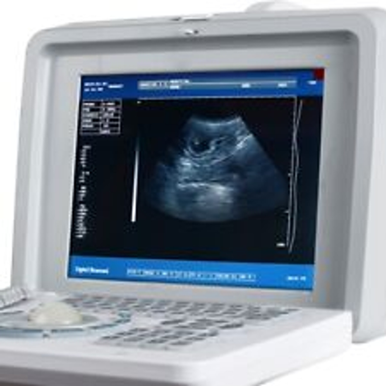 Digital Ultrasound Scanner Equipment 3.5MHZ Convex Probe External 3D Software