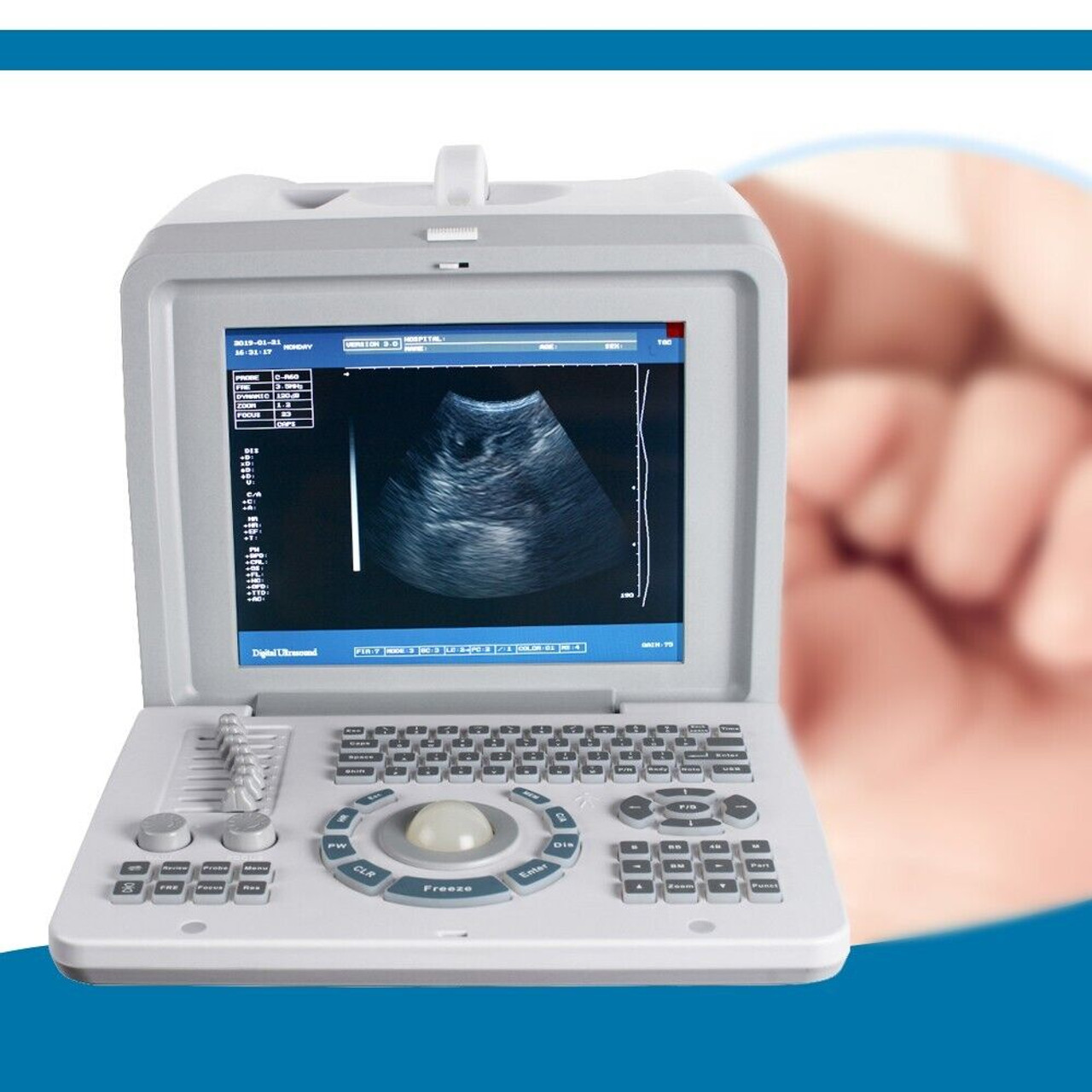 Digital Ultrasound Scanner Equipment 3.5MHZ Convex Probe External 3D Software