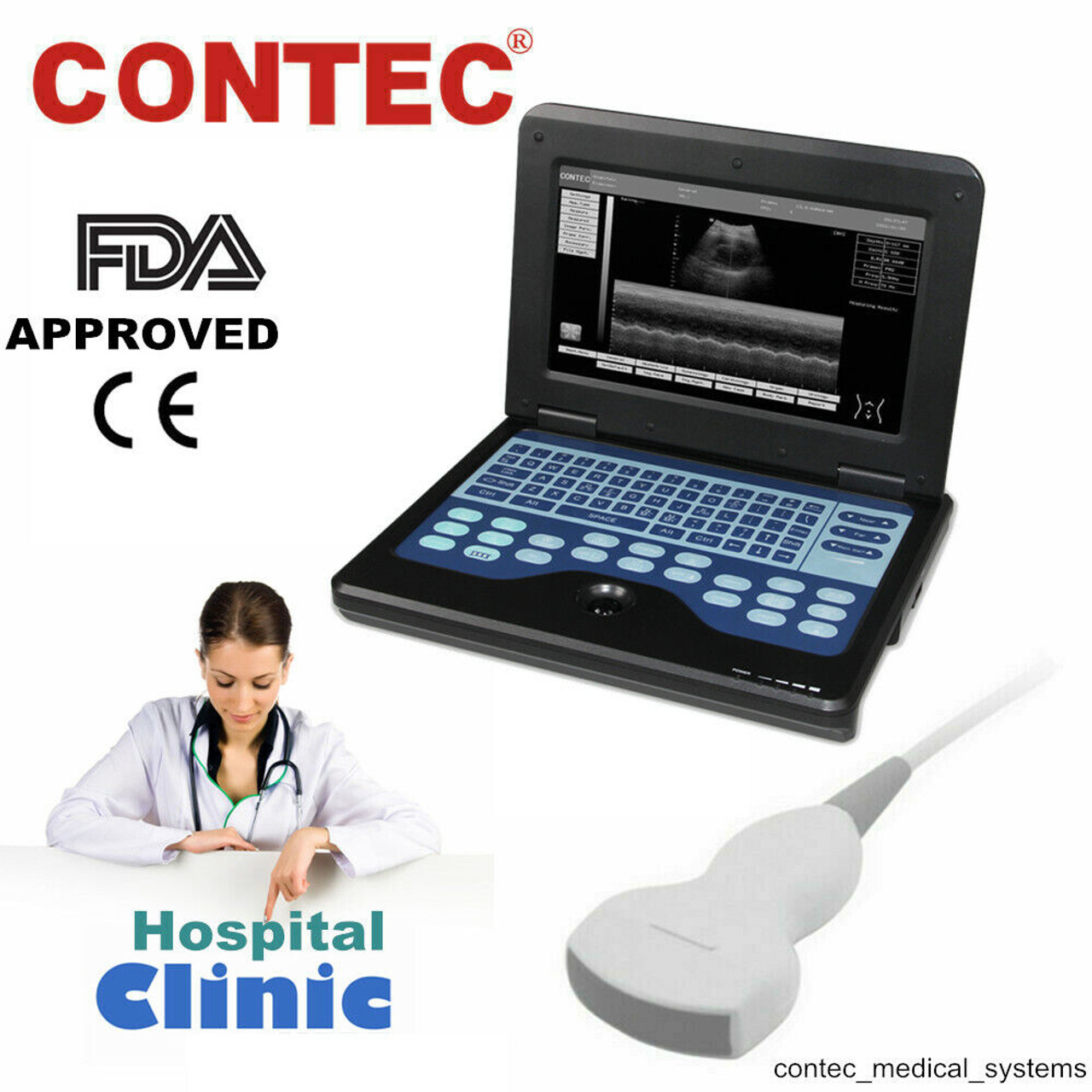 CMS600P2 Portable Laptop Diagnostic Ultrasound Scanner Machine Convex Probe Fda