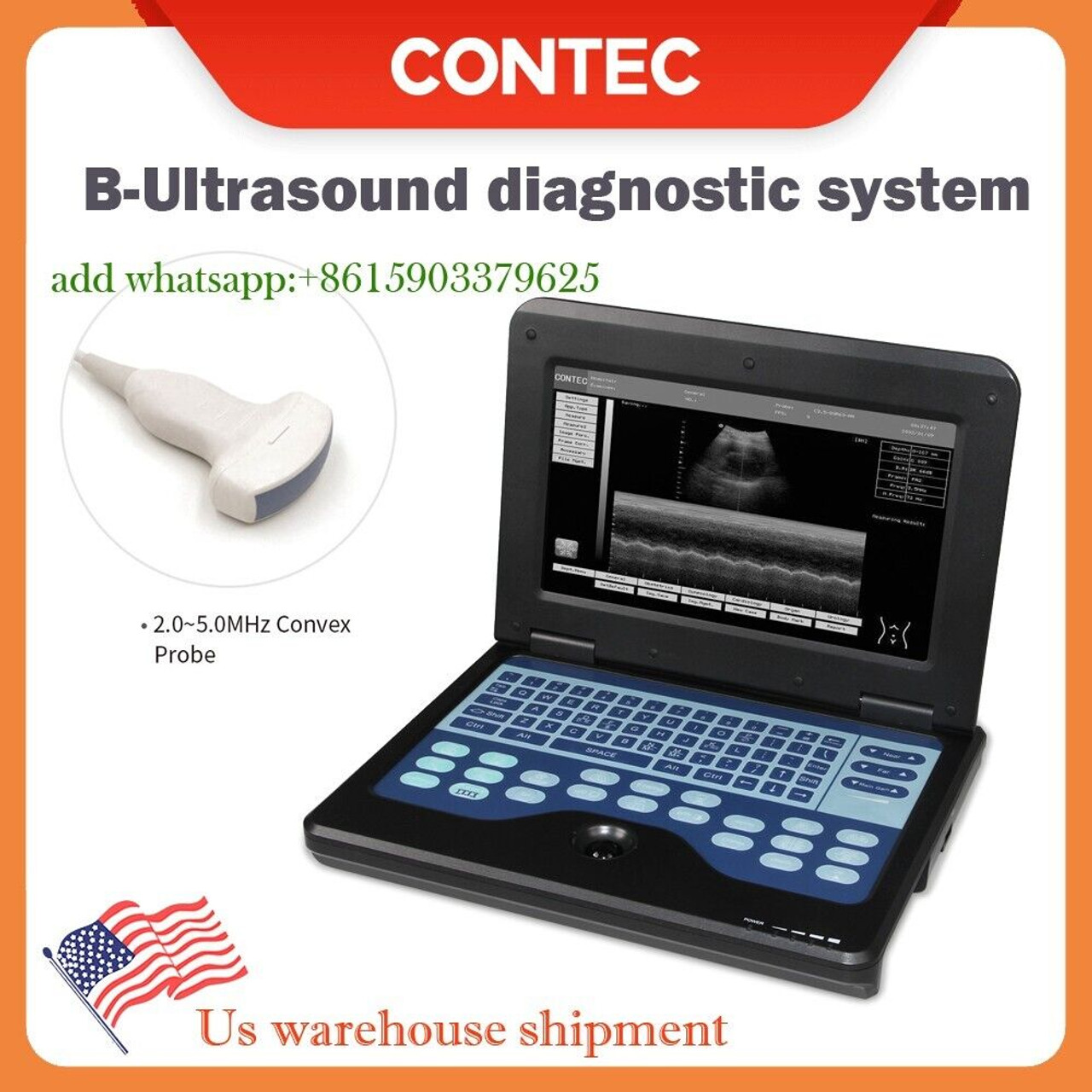 Portable Ultrasound Machine Contec CMS600P2 Ultrsound Scanner+convex Probe