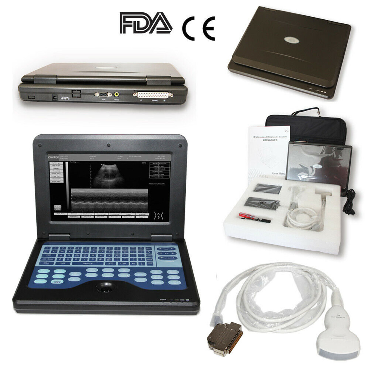 CMS600P2 Digital Ultrasound Scanner Portable Laptop Machine 3.5MHZ Convex Probe