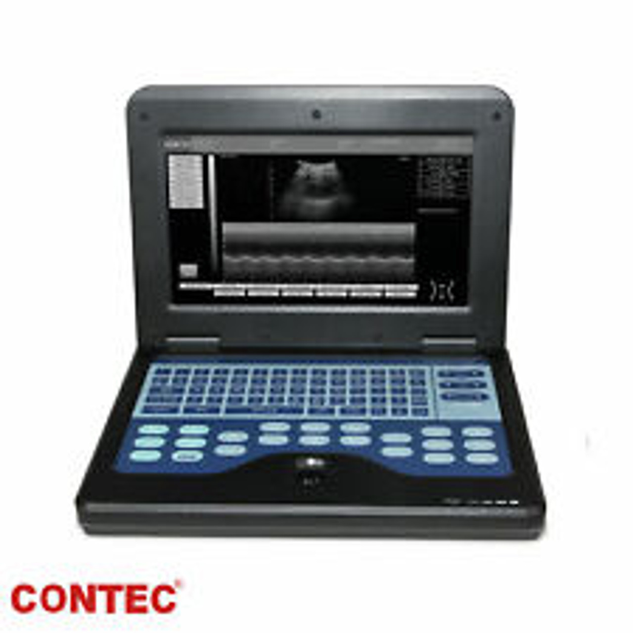 Portable Ultrasound Scanner Laptop Ultrasound Machine 3.5MHZ Convex Probe Fda Us