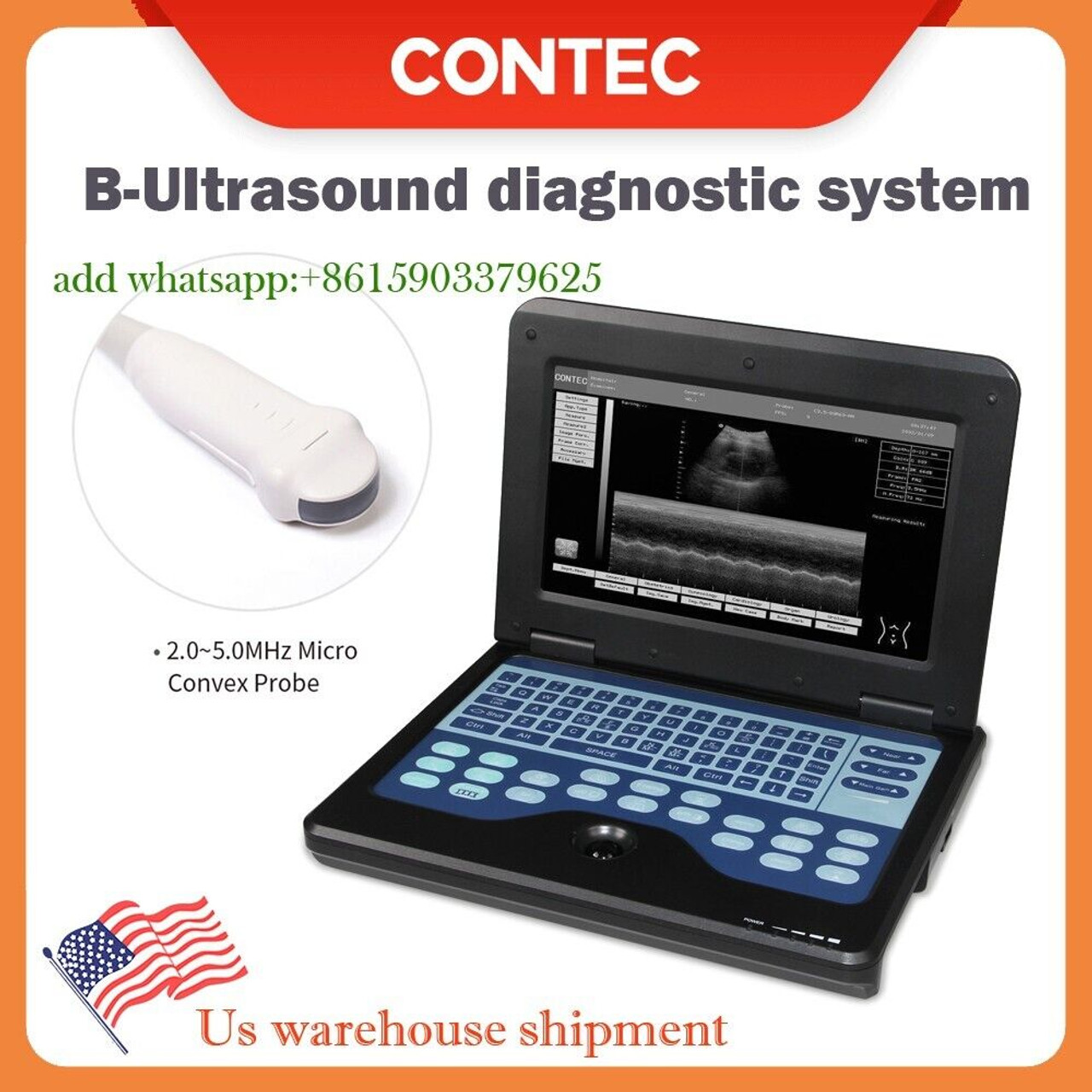 Cardiac Ultrasound Laptop Machine Digital Ultrasound Scanner+cardiac Probe