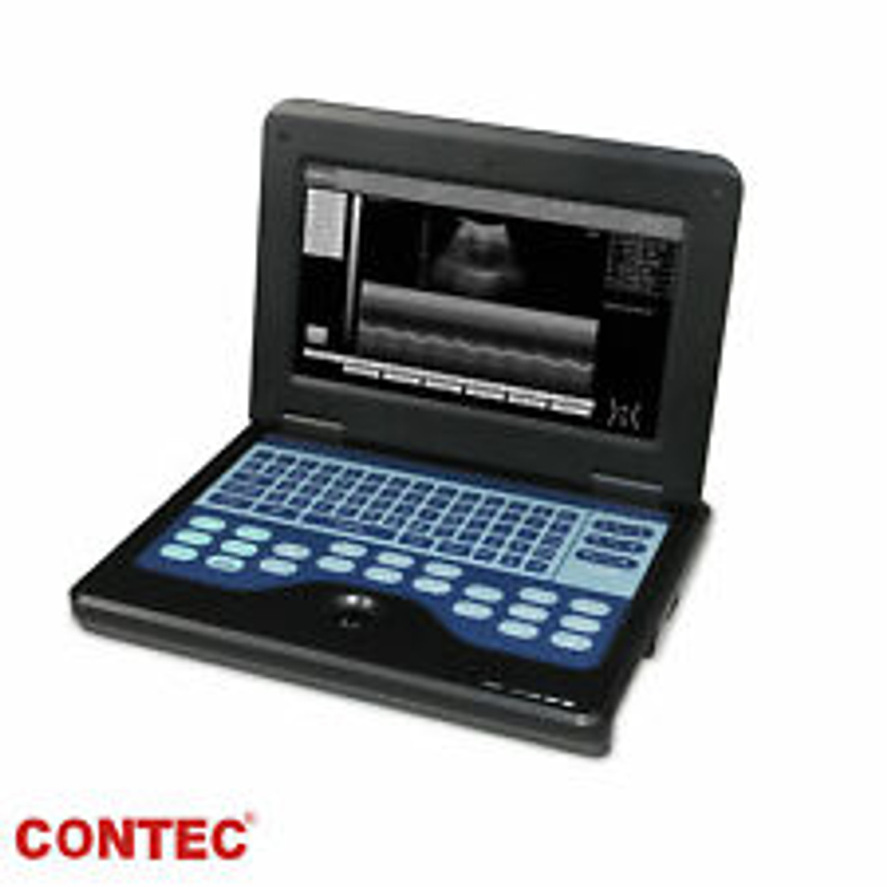 Portable CMS600P2 Laptop Ultrasound Scanner Machine 7.5mhz Linear Probe Fda