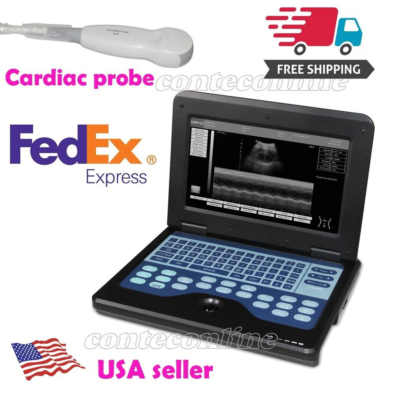 Fda Portable Ultrasound Scanner Laptop Machine CMS600P2 Human,cardiac Probe