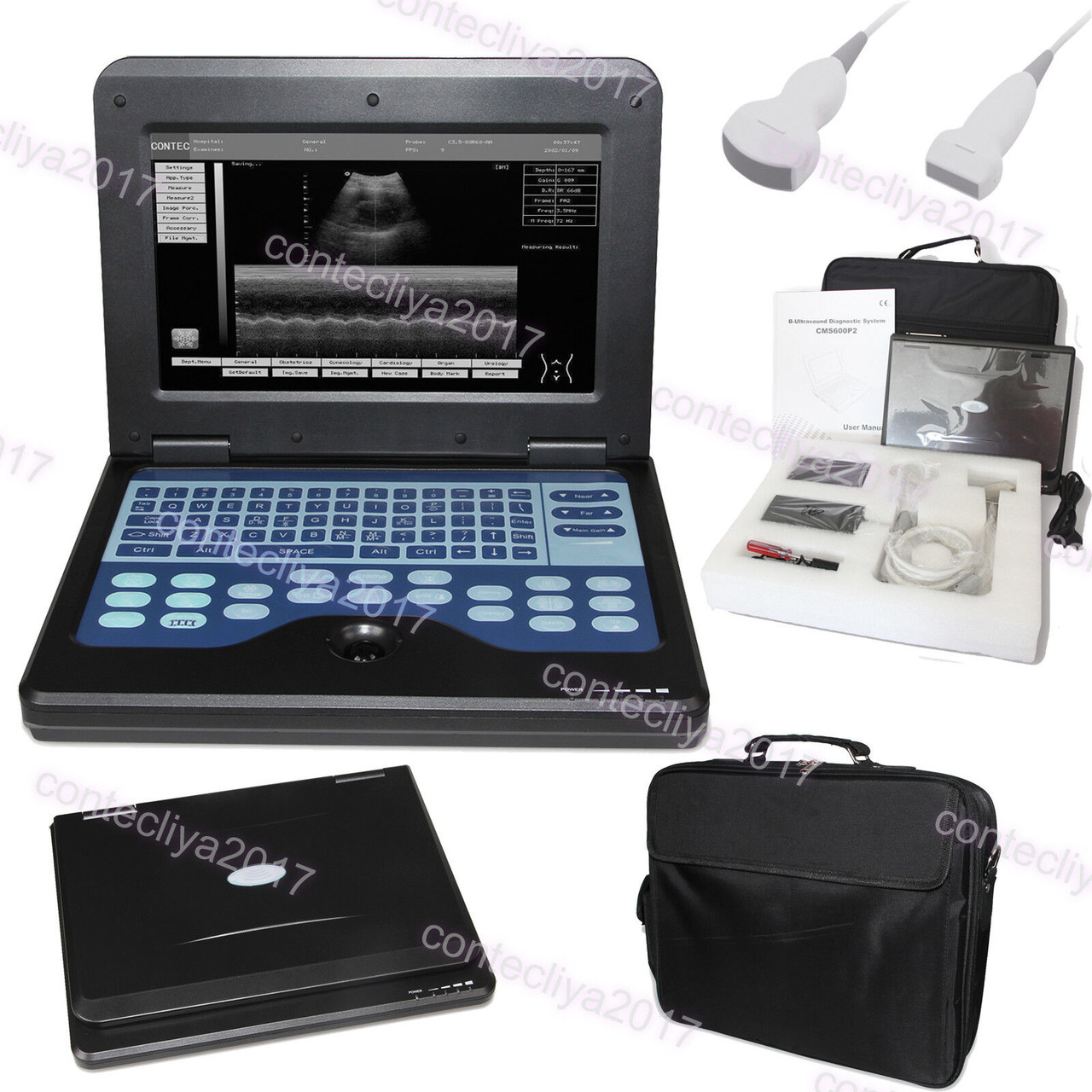 10.1 Portable Ultrasound Scanner Digital Laptop Machine Convex+linear 2 Probes