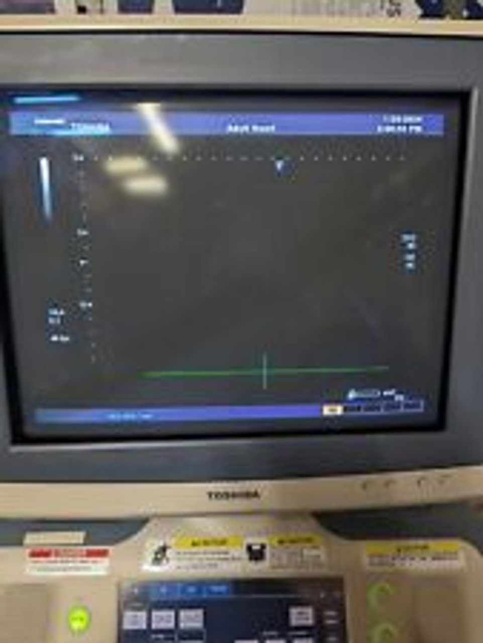 Toshiba Xario Ultrasound