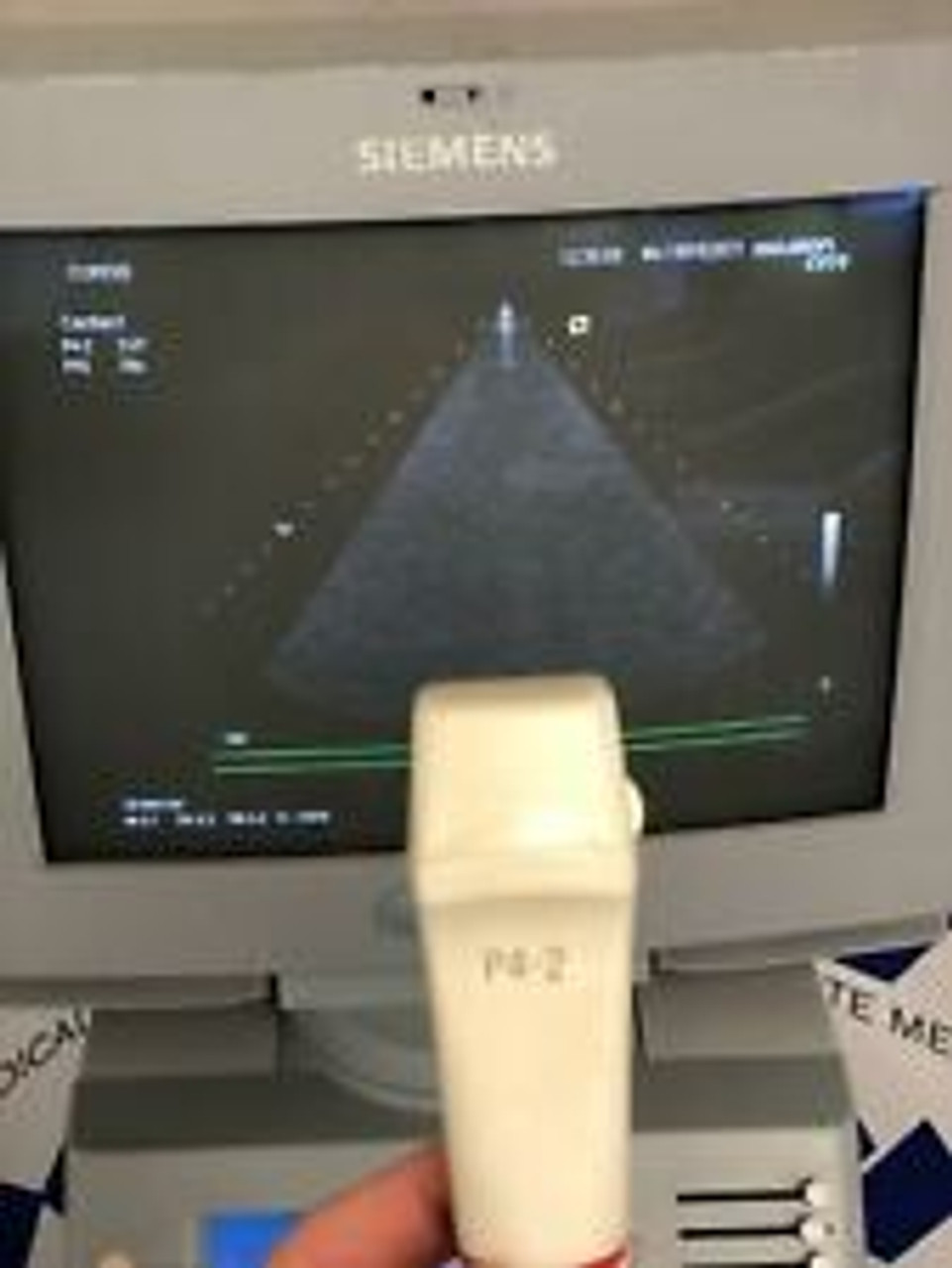 Siemens Acuson CV70 Ultrasound Machine W P4-2 Cardiac Probe