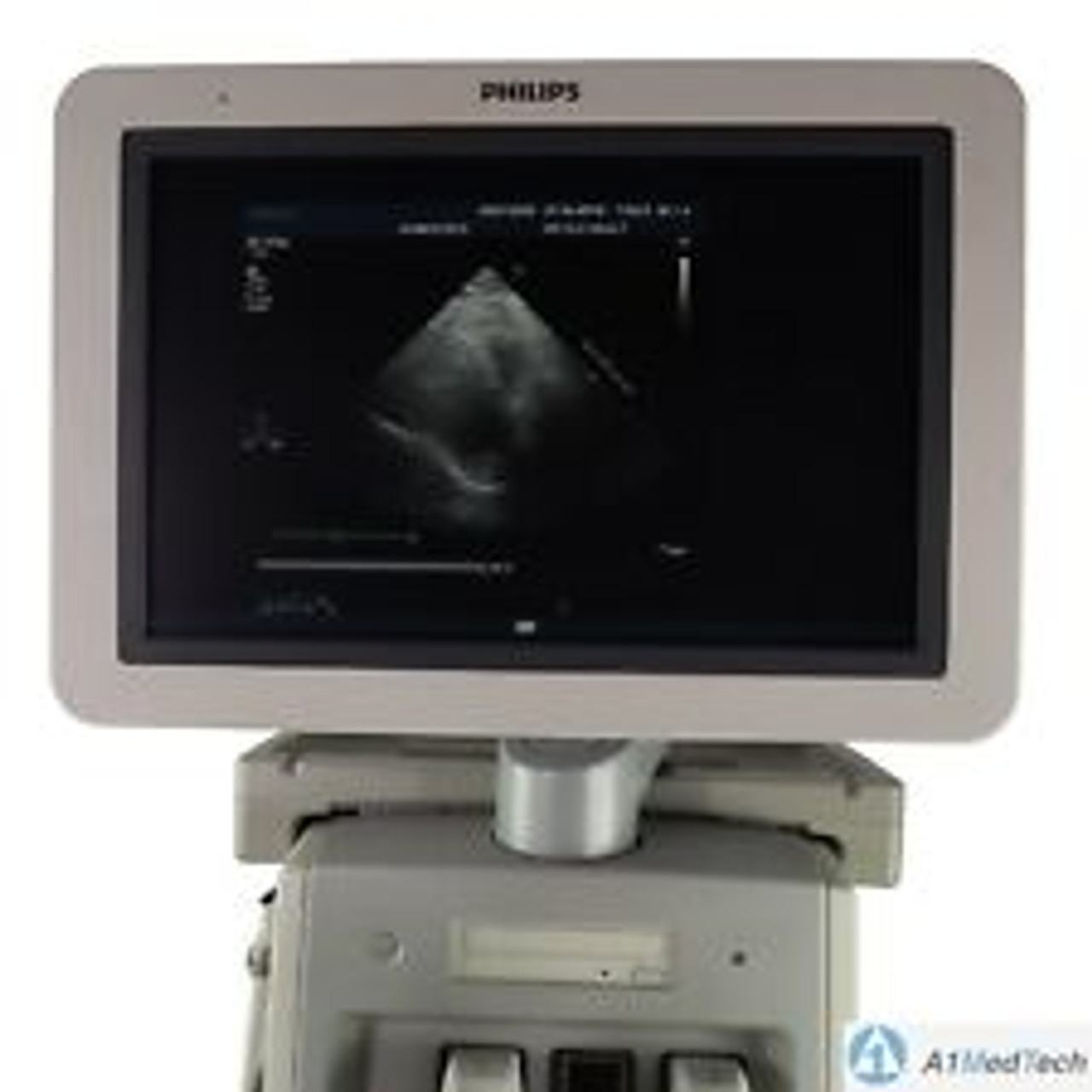 Philips IE33 Ultrasound System G Cart S5-1 L9-3 D2CWC Probes Recorder