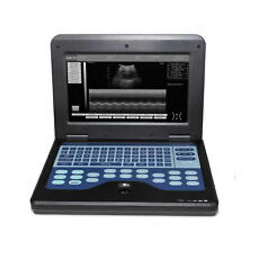 Fda Ce 10.1 Inch Portable Ultrasound Scanner Laptop Machine CMS600P2 Human