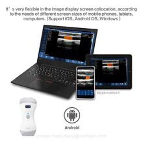 Veterinary Color Doppler Ultrasound Machine Handheld Wifi Convex Linear Probe