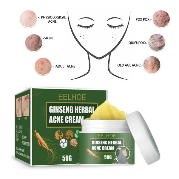 Ginseng herbal acne cream 50g
