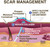 Scar Management