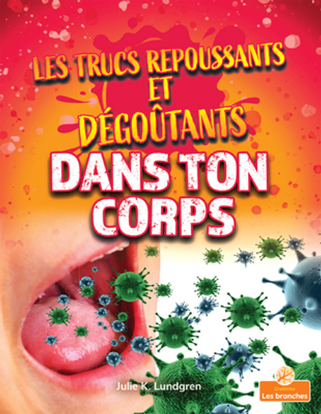 Les Trucs Repoussants Et Dégoûtants Dans Ton Corps (Gross and Disgusting Stuff in Your Body) (Paperback) Les Trucs Repoussants Et Dégoûtants Dans Ton Corps (Gross and Disgusting Stuff in Your Body) (Paperback)