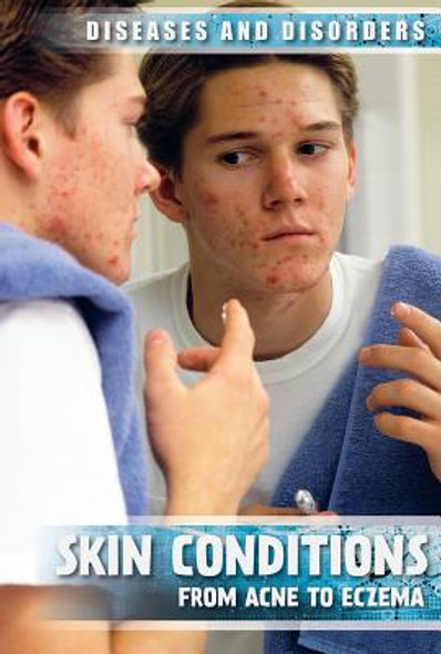 Skin Conditions: From Acne to Eczema (Paperback)