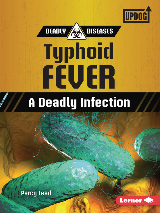 Typhoid Fever: A Deadly Infection (Paperback) Typhoid Fever: A Deadly Infection (Paperback)