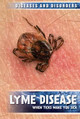 Lyme Disease: When Ticks Make You Sick (Library Binding)