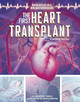 The First Heart Transplant: A Graphic History (Paperback)