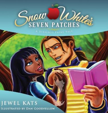 Snow White's Seven Patches: A Vitiligo Fairy Tale Jewel Kats 9781615992072