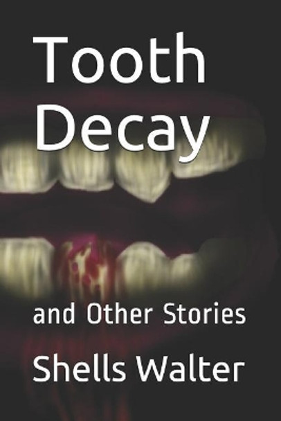 Tooth Decay: And Other Stories Shells Walter 9781732913691