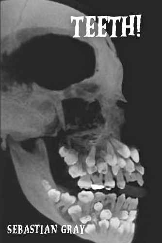 Teeth! by Sebastian Gray