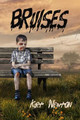 Bruises by Kurt Newton