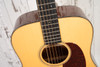 Collings D1A Traditional - Adirondack  Spruce Top (Used)