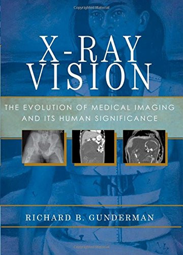 X-Ray Vision: The Evolution of Medical Imaging and Its Human Significance