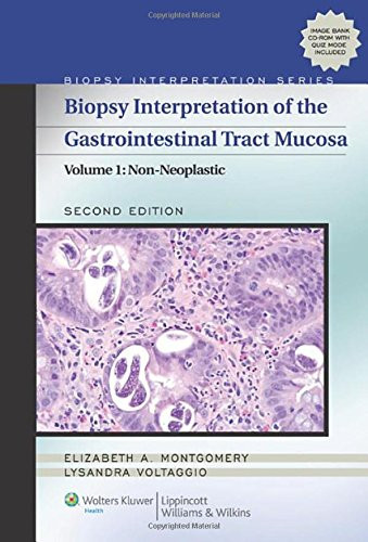 Biopsy Interpretation of the Gastrointestinal Tract Mucosa: Volume 1: Non-Neoplastic (Biopsy Interpretation Series)