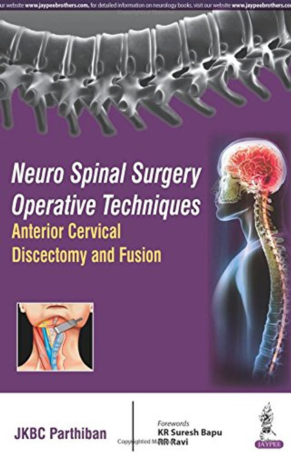 Neuro Spinal Surgery Operative Techniques: Anterior Cervical Discectomy and Fusion