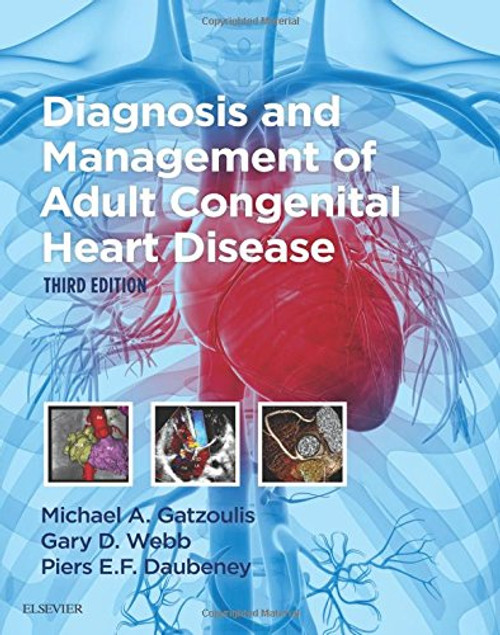Diagnosis and Management of Adult Congenital Heart Disease, 3e
