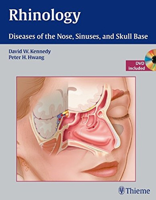 Rhinology: Diseases of the Nose, Sinuses, and Skull Base Rhinology: Diseases of the Nose, Sinuses, and Skull Base