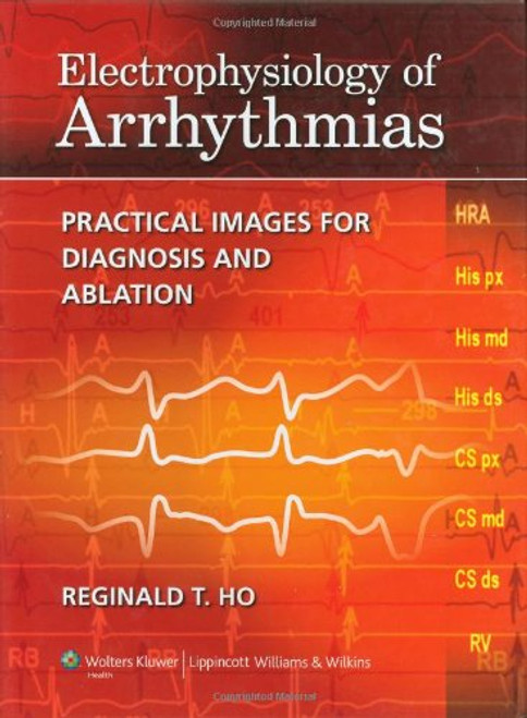 Electrophysiology of Arrhythmias: Practical Images for Diagnosis and Ablation