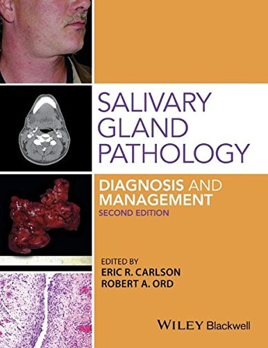 Salivary Gland Pathology: Diagnosis and Management