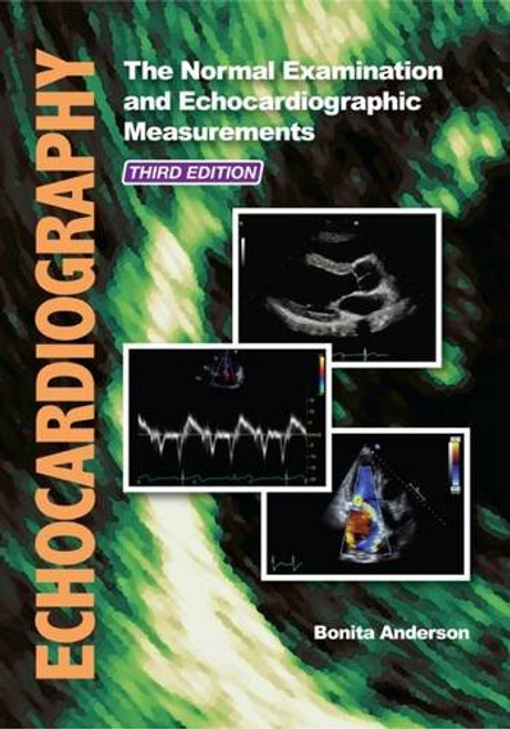Echocardiography: The Normal Examination and Echocardiographic Measurements Echocardiography: The Normal Examination and Echocardiographic Measurements