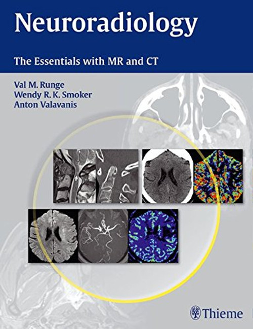 Neuroradiology: The Essentials with MR and CT