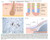 Robbins & Cotran Pathologic Basis of Disease: With STUDENT CONSULT Online Access, 8e (Robbins Pathology)