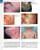 Andrews' Diseases of the Skin: Clinical Dermatology, 12e