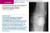 Robbins and Cotran Pathology Flash Cards, 2e (Robbins Pathology)