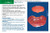 Robbins and Cotran Pathology Flash Cards, 2e (Robbins Pathology)
