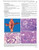 Differential Diagnosis in Surgical Pathology, 3e