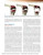 Techniques in Revision Hip and Knee Arthroplasty, 1e